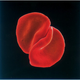GABRIEL PETER - HIT (LMT.) - 2CD